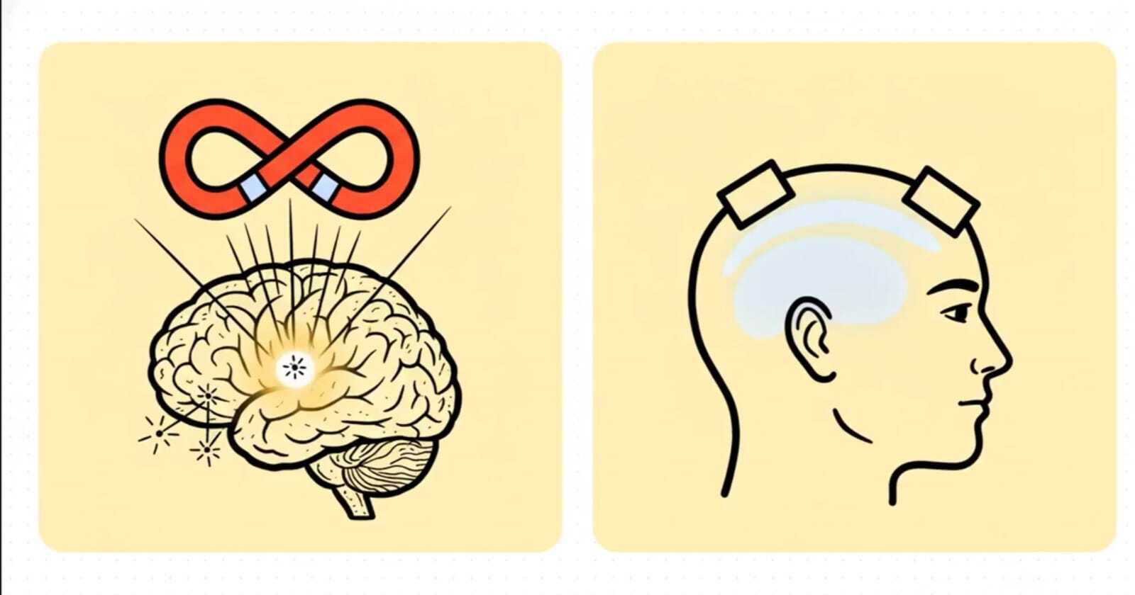Translational Neurorehabilitation